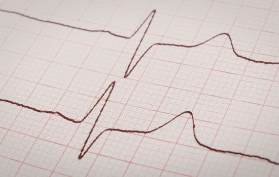 Cardiac Monitoring App Revolutionizes Heart Health